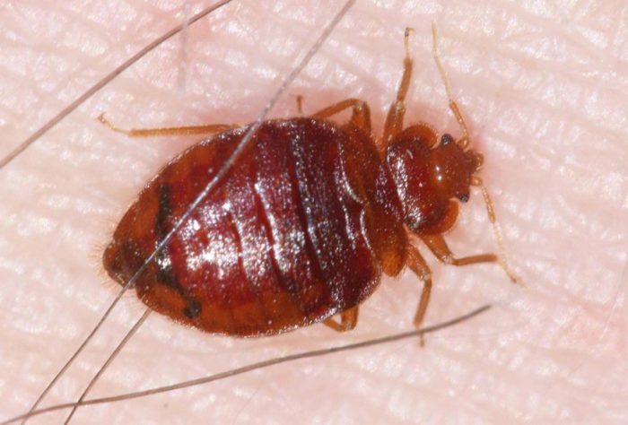 Bed Bugs on someones skin